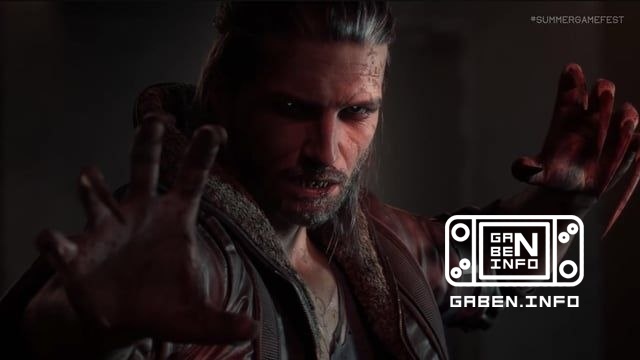 🧛♂️ أكد مدير لعبة The Blood of Dawnwalker، كونراد توماسكيويتز، أن المشهد مع كوهين في الوقت الحاضر المعروض في Summer Game...