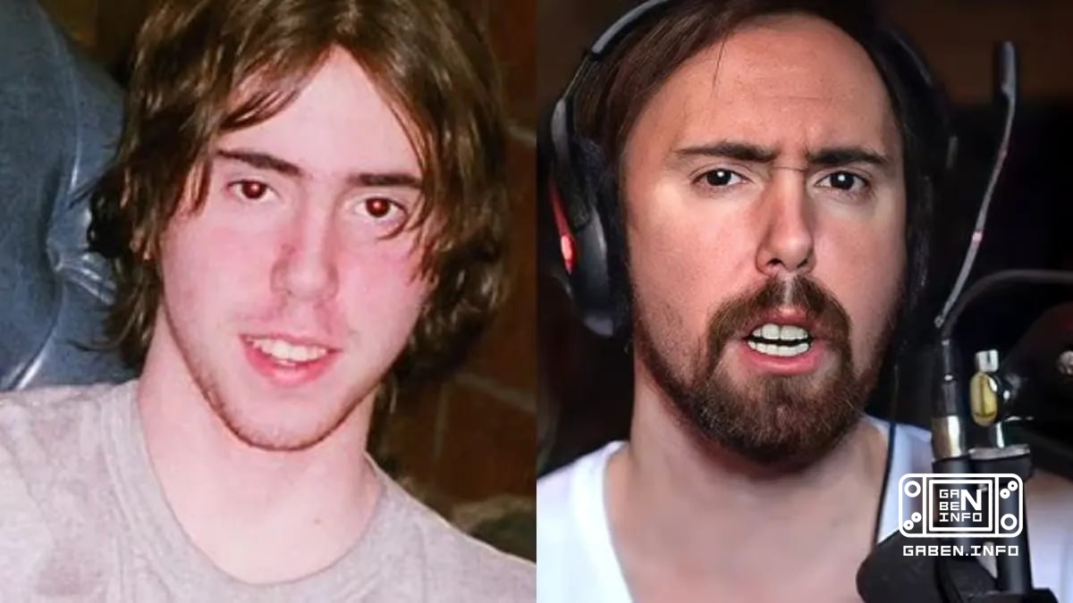 You don't want to end up like me. I've changed my face dramatically, because now I only eat with my front teeth and I do...